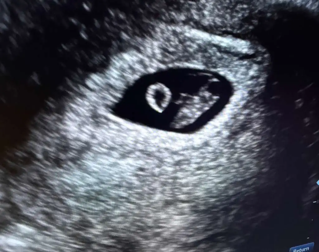 pregnancyconfirmation