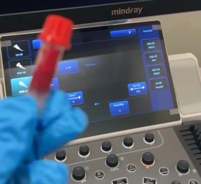 peekaboo imagen buena